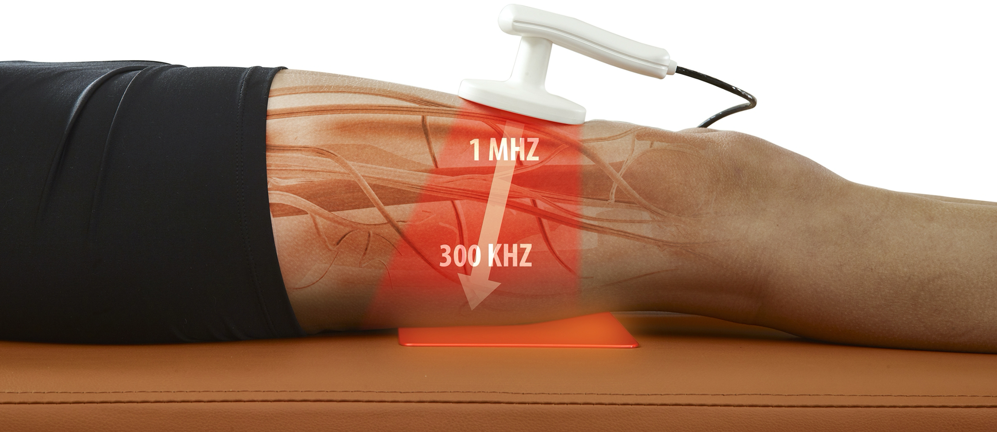 TECAR therapie spieren
