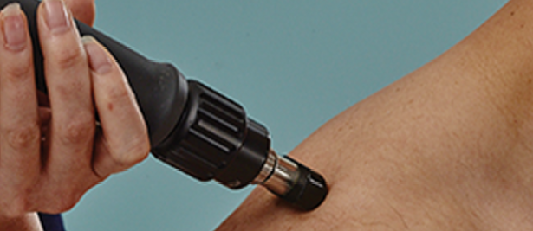 Shockwave behandeling
